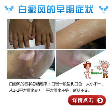白癜风的早期症状.jpg