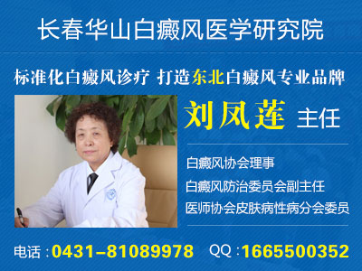 长春哪家医院治疗白癜风最好